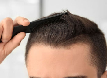 FUE Hair Transplant 