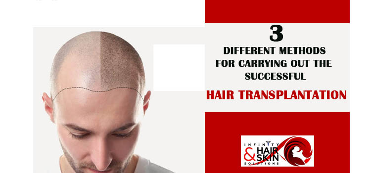 3 Different methods for carrying out the successful hair transplantation