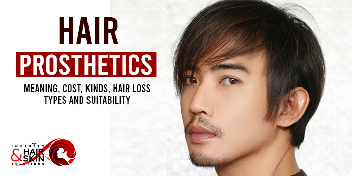 Hair prosthetics - Meaning, Cost, Kinds, Hair loss types and Suitability