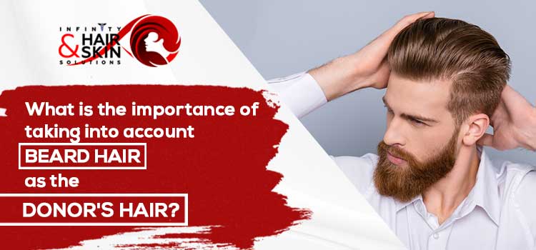 What is the importance of taking into account beard hair as the donor's hair?