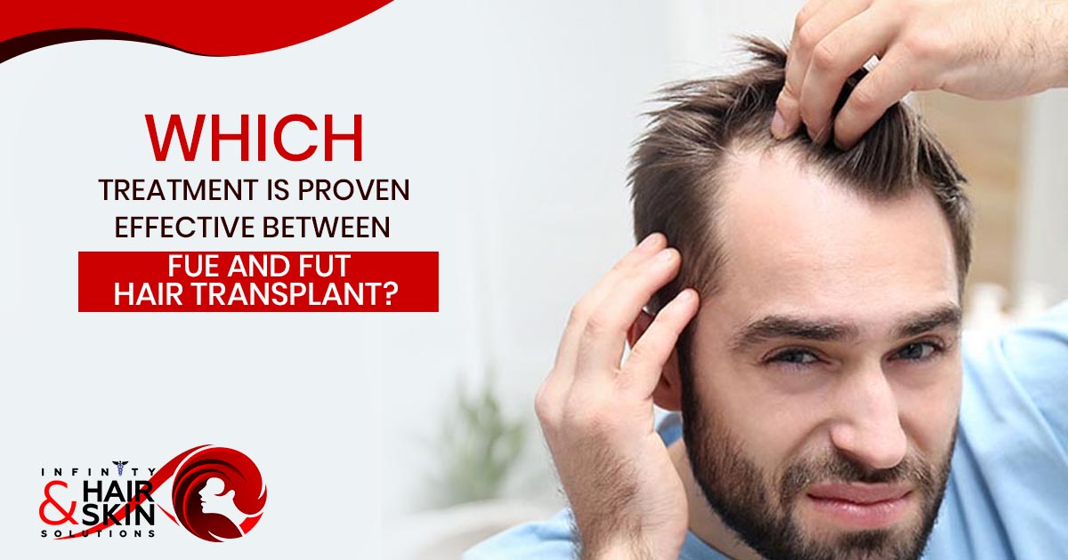Both FUE and FUT hair transplant methods are highly in demand and people can contact with our team of experts. For permanent results patients can go with FUE hair transplant.