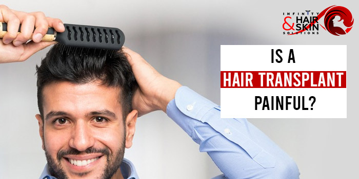 Is a hair transplant painful