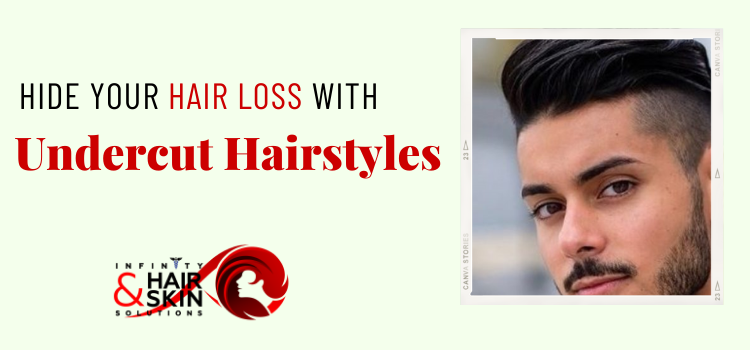 Why are undercut hairstyles famous? How can this help to hide hair loss?