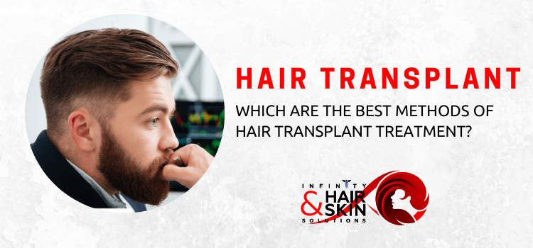 Hair transplant: Which are the best methods of hair transplant treatment?