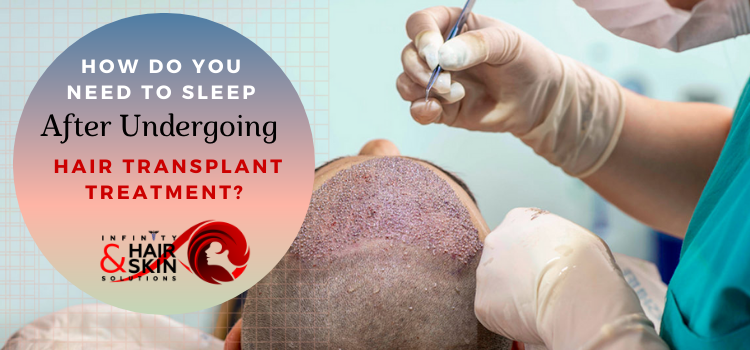 How do you need to sleep after undergoing hair transplant treatment?