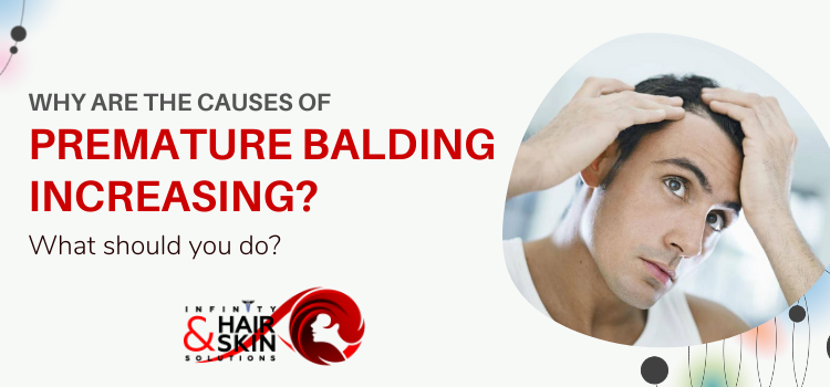 Why are the causes of premature balding increasing? What should you do?