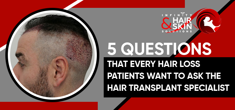 5 Questions That Every Hair Loss Patients Want To Ask The Hair Transplant Specialist